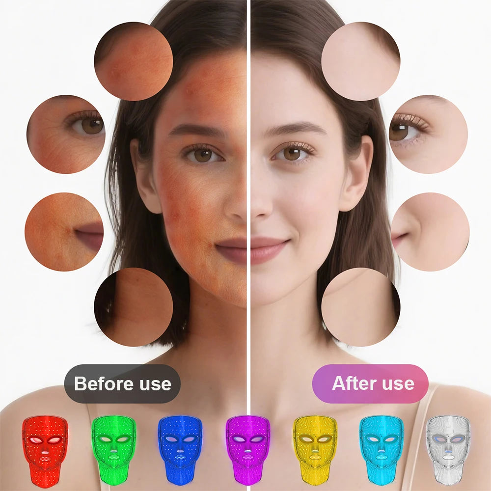 7-Color Photon Face & Neck Mask – LED Anti-Aging Skin Rejuvenation Device